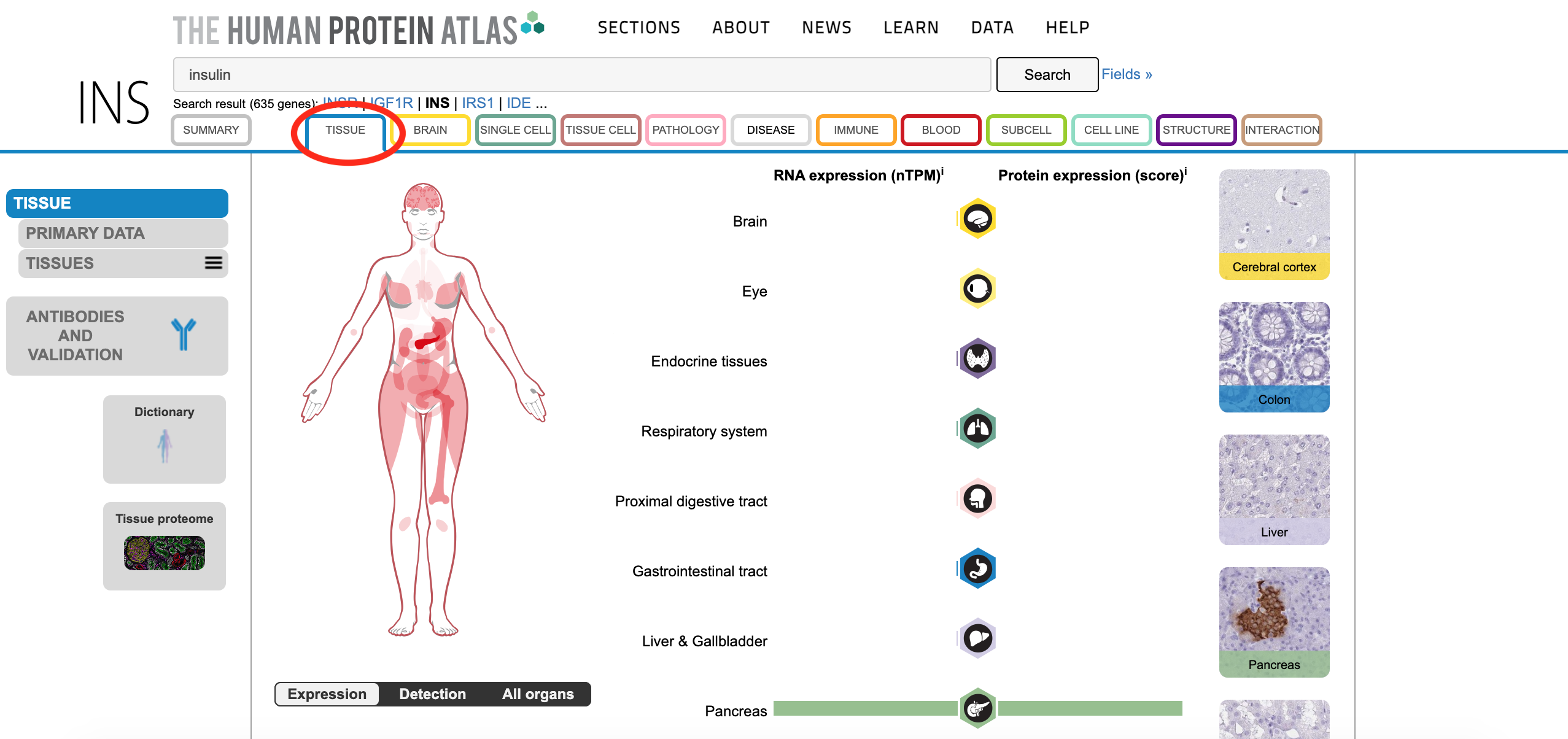 Screenshot of the Tissue tab of the Human Protein Atlas entry for INS. It contains graphical summaries of insulin localization. A diagram of a human body has several areas colored lightly, and the pancreas colored darkly. Bar plots for RNA and protein expression both show high expression in the pancrease and little to no expression anywhere else. There are also images of different tissues stained to detect insulin expression - only the pancrease tissue has dark staining.