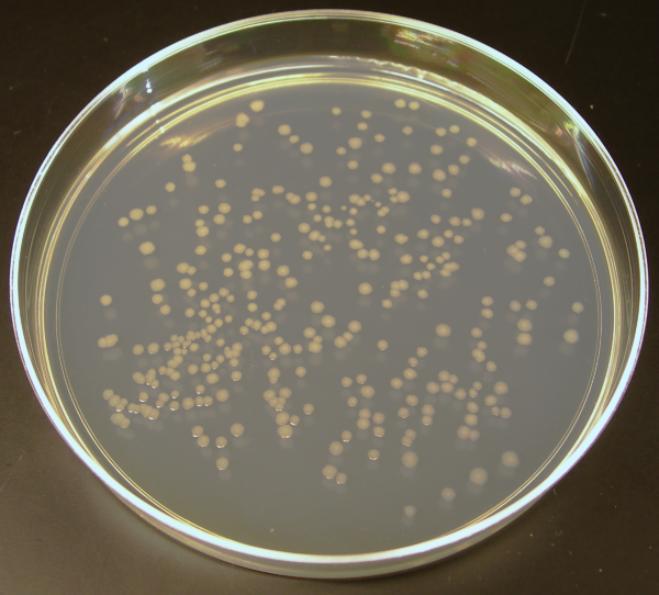 Photo of E. coli growing in a petri dish