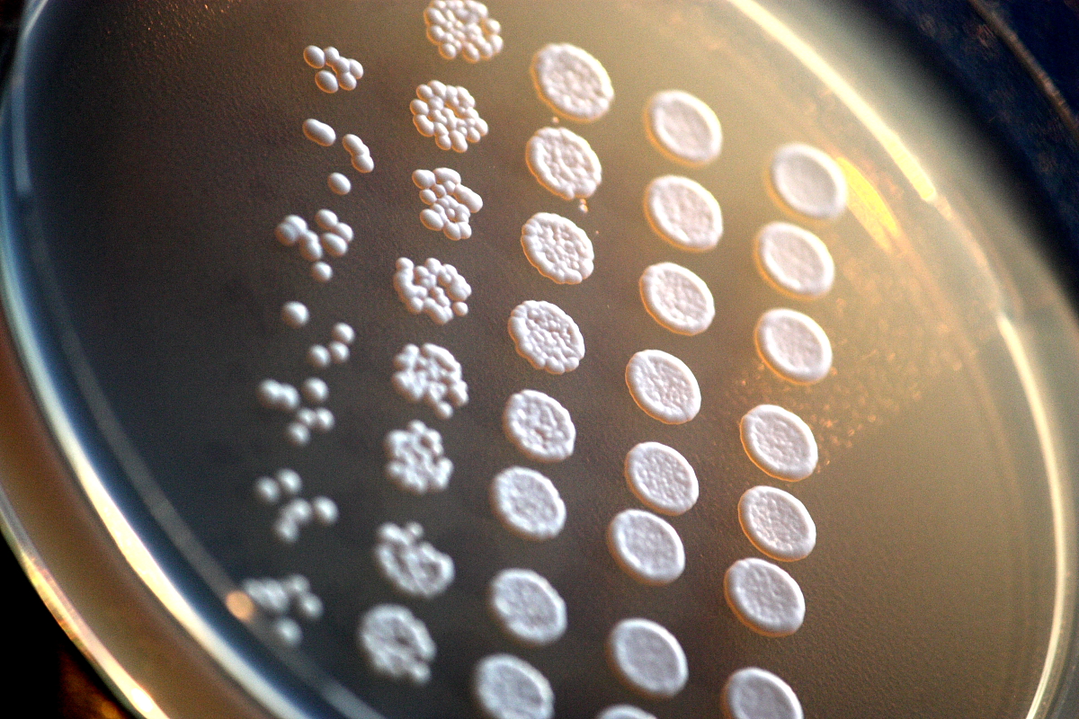 Photo of yeast growing in a petri dish